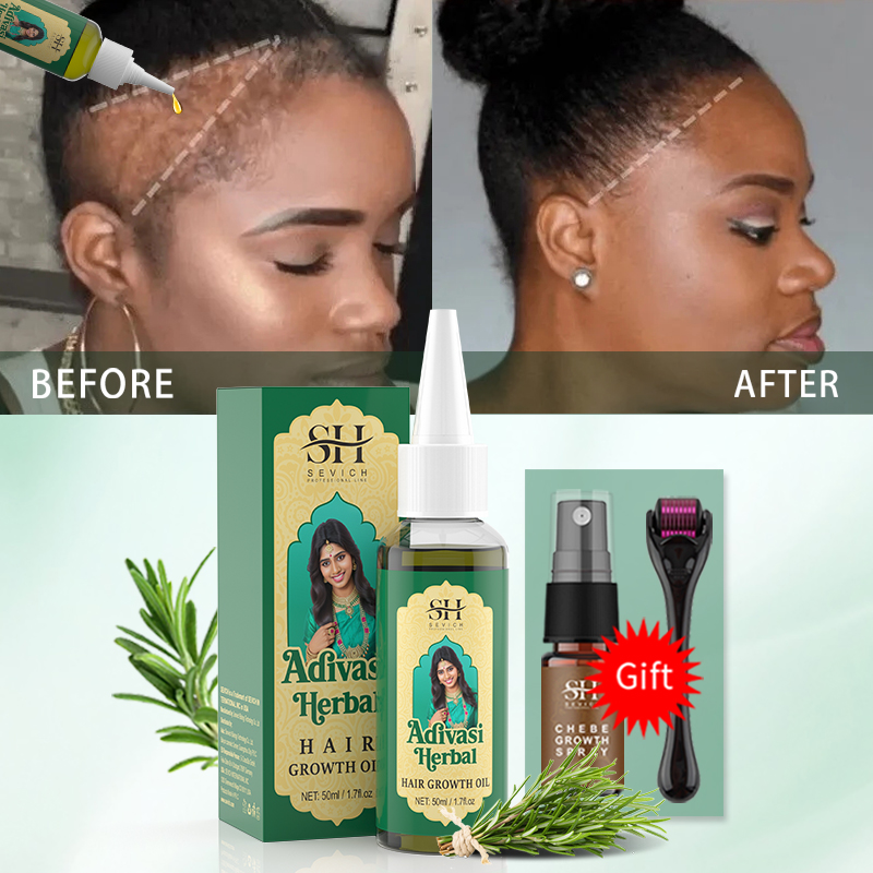 Ayurvedische haargroeiolie Ind - Hair Care Essence Oil recensie en prijs