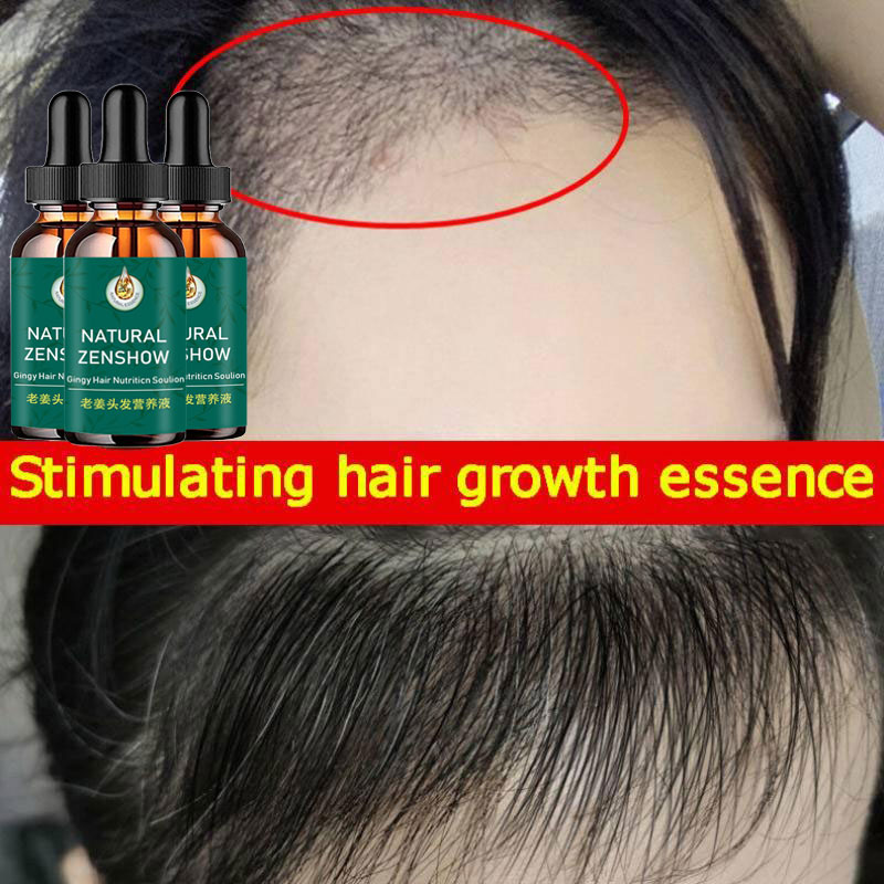 Gember Haargroei Etherische Ol - Hair Care Herbal recensie en prijs