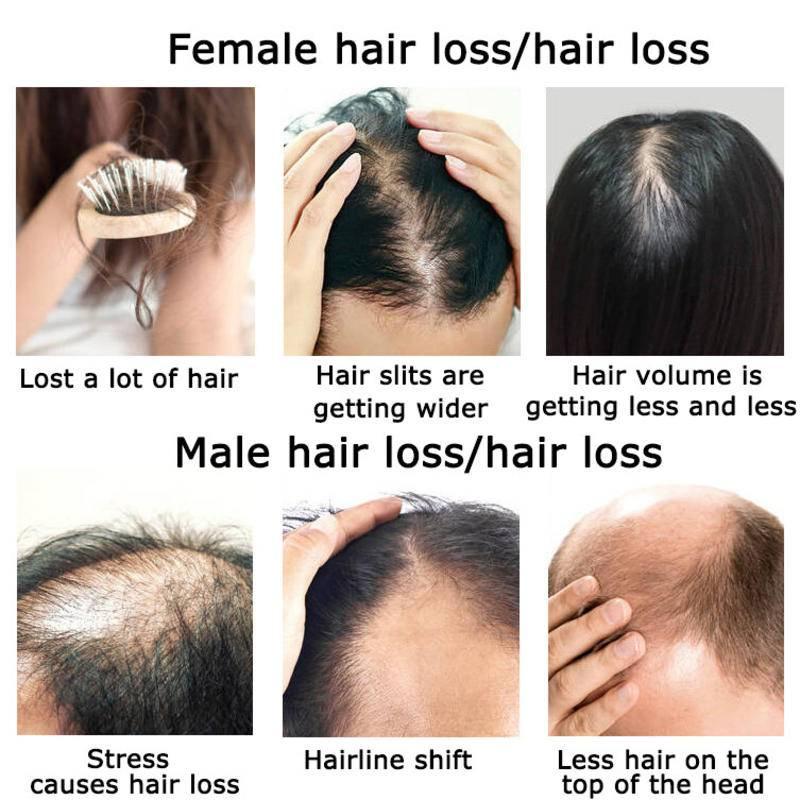 Gember Haargroei Etherische Ol - Hair Care Herbal recensie en prijs